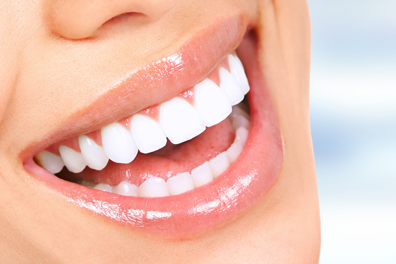 Cosmetic Dentistry in Des Moines